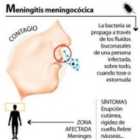 /album/fotogaleria/meningitis-meningocica-jpg/